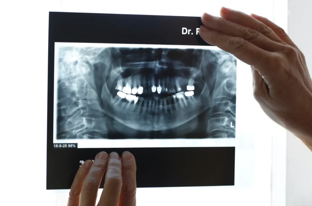 Radiología Oral Zipaquirá