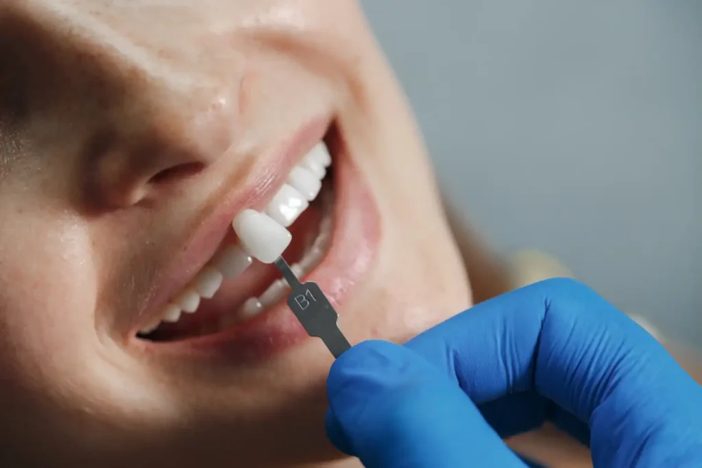 Implantes Dentales Zipaquirá